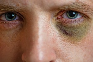 Expanding Victims' Rights